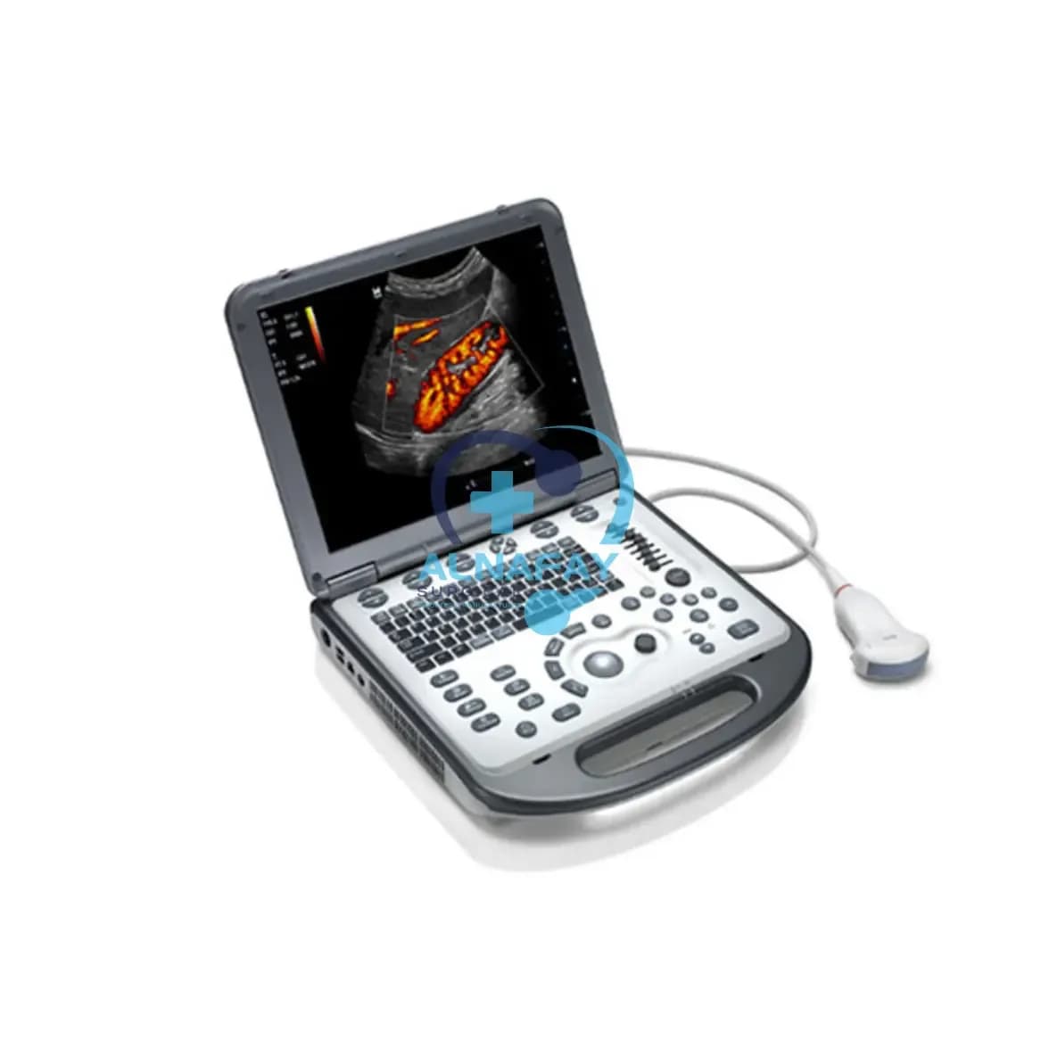 Mindray ultrasound machine — quoted on request.